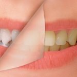 Xylitol: Sweetening Your Health and Your Smile