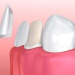 Jaw Pain and Dental Health: When to See a Dentist