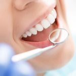 Can Stem Cell Therapy Replace Teeth Whitening Procedures?