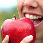 What are the Conditions for the Requirement of Full Mouth Restoration? 