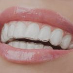 What to Expect During and After Sedation Dentistry