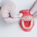 Creating Confident Smiles: How Family and Cosmetic Dentistry Enhances Oral Health for All Ages