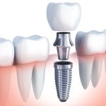 How Orthodontics Improves More Than Just Your Smile