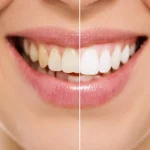 How Family Dentists Provide Personalized Care For Every Patient