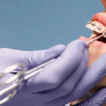 4 Health Risks Of Ignoring A Missing Tooth